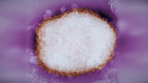 According to who, the monkeypox virus is similar to human smallpox. What Is Monkeypox The Rare Virus That Has Turned Up In The U K