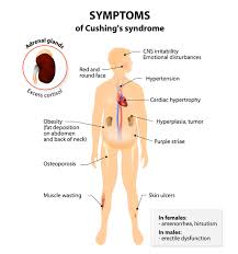Maybe you would like to learn more about one of these? Cushing Disease Medlineplus Genetics