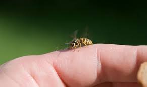 How to get bees to go away. Bee Sting What Treatments And Remedies Actually Work