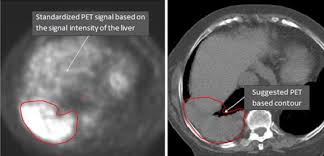 Paul is the place we call home, and our every effort goes back to making this city a better place for pets and the people who love them. Pet Ct Imaging For Target Volume Delineation In Curative Intent Radiotherapy Of Non Small Cell Lung Cancer Iaea Consensus Report 2014 Radiotherapy And Oncology