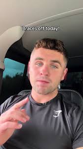 The wedding countdown is well and truely on! Big shoutout to @Zen  Orthodontics for the treatment. Use code 'Ruairi50' for 50% off your first  consultation 😀🦷