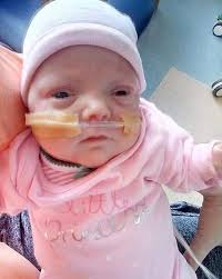 Đang mang thai 22 tuần, bố mẹ hốt hoảng khi thai nhi trượt ra khỏi bụng