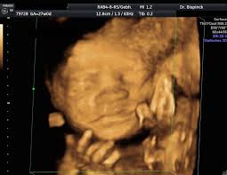 4d ultraschall nutzlich oder nur vergnugen baby und familie. 3d 4d Ultraschall Frauenarztpraxis Dusseldorf