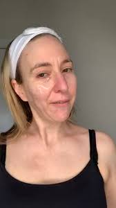 Part 2 removal of mask, massage...