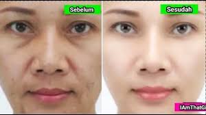 Keduanya bekerja dengan cara menurunkan tegangan permukaan sehingga kotoran yang menempel. Petua Menegangkan Kulit Muka Cute766