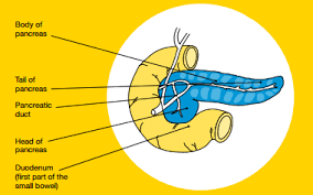 Malignant cells can therefore easily spread from the pancreas to other important tissues via the bloodstream or lymphatic system. November Is Pancreatic Cancer Awareness Month Cancer Council Western