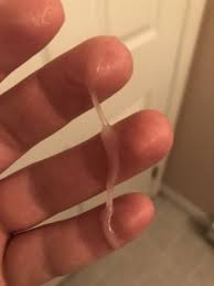 Cervical Mucus 6 Days Before Af Trying For A Baby Babycenter Canada