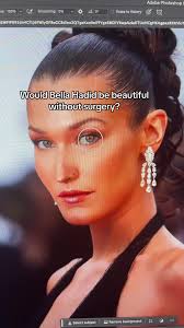 Bella Hadid's Beauty: Beyond Plastic Surgeries