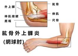 Contribute to fwonggh/bthub development by creating an account on github. åª½åª½æ‰‹ ç¶²çƒè‚˜å'Œé›»è…¦æ‰‹æœ‰æ•'å–‡ æ‰‹ç—›ä¸€åˆ‡çš†å› ç­‹ç™¼ç‚Ž Medimartæ¨‚åº·è»' æ‚¨çš„è­·ç†å°ˆå®¶ Medimart æ¨‚åº·è»'