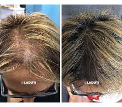Die 16 Besten Haarwuchsmittel Fur Frauen Und Manner Test 2021