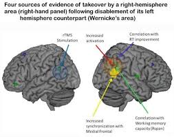 Pin On Neuro Anatomy Cognitive Rehab Research
