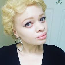Check spelling or type a new query. 10 Stunning Photos Of Black Albinos From The Inmyskiniwin Campaign Celebrating Albino Beauty Bglh Marketplace