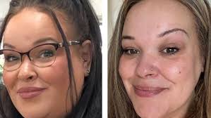 Plans to give jabs to the unemployed to help them lose weight is 'naive'