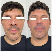 Dr. Omar Nolasco 👨‍⚕️ (@dr_omarnolasco) • Instagram photos and videos