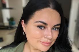 Chciała pozbyć się podwójnego podbródka. Zrobiła liposukcję i twierdzi, że  wygląda jak postać ze Shreka