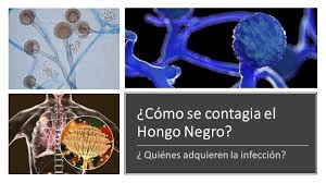 La mucormicosis es una infección rara pero grave causada por los hongos de los géneros mucor, abdsidia y rhizopus que afecta la cavidad nasal y india es uno de los países con las tasas más altas de diabetes en adultos en el mundo. Como Se Contagia El Hongo Negro A Quienes Le Da Esta Infeccion Fungica Youtube