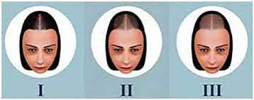 Androgen receptors are proteins that allow hormones like testosterone and dht to bind to them. Hair Loss In Women Different Than In Men Now Assured Better Treatment