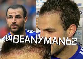 Cenk tosun statistics played in besiktas. Haartransplantation Forum
