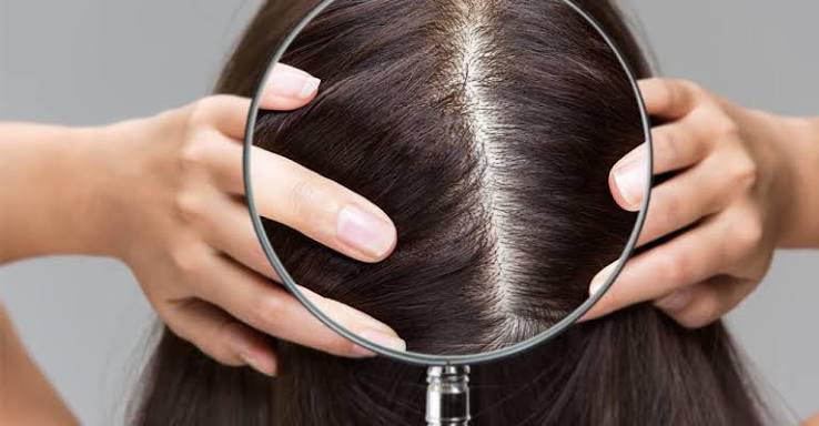 Scalp treatment approach at Profrea