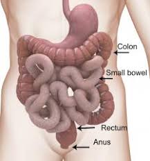 Bowel cancer may be diagnosed after you visit your doctor with symptoms, or if a screening test shows signs that you might have bowel cancer. What Is Bowel Cancer