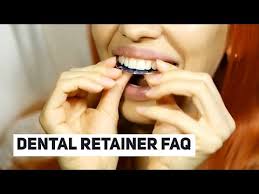 The more you wear it the better results you will have. Do I Have To Wear My Retainer Forever Advanced Orthodontic Care