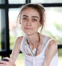 23-year-old Whangarei woman Ruby Hill left to starve to death without any  pain relief