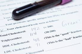 In the past, cholesterol levels have been considered highly correlative to cardiovascular disease. What Is Total Cholesterol And What Does It Mean