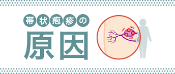 Primary infection usually occurs in childhood, producing. å¸¯çŠ¶ç–±ç–¹ Jp å¸¯çŠ¶ç–±ç–¹ã®åŽŸå›  ç—‡çŠ¶ æ²»ç™‚æ³•ã«ã¤ã„ã¦ç´¹ä»‹
