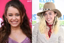 See more ideas about miley, miley cyrus, cyrus. Zahne Der Stars Der Vorher Nachher Vergleich Brigitte De