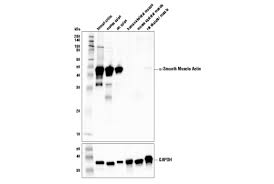 Smooth muscle tissue anatomy relaxed contracted stock. A Smooth Muscle Actin 1a4 Mouse Mab Ihc Formulated Cell Signaling Technology