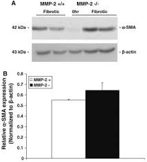 There are 3 different types of muscle: A Smooth Muscle Actin A Sma Expression Is Not Decreased In Mmp 2 Download Scientific Diagram
