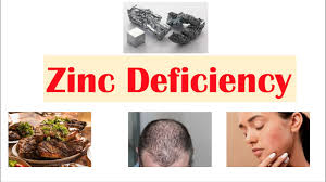 Image result for Zinc Deficiency