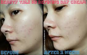 Free delivery and returns on ebay plus items for plus members. Beauty Talk 3d Refining Day Cream Review Skinfrosting