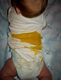 You could do this yourself if handy with a sewing machine or other fabric devices. Famous Onesie Hack New Parents Need To Know