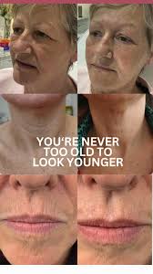 You’re never too old to look younger