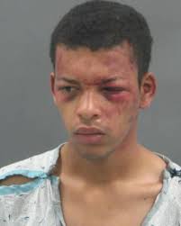 St. Louis police officer's condition improves