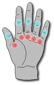 I read another forum that said that the pain is due to keeping your arms bent for long periods of time. Flexor Tendinitis Trigger Finger