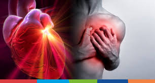 Angina pectorala, in cazul in care ea reprezinta diagnosticul medicului, este un serios semnal de alarma pe care inima o trage, angina fiind la randul ei un simptom pentru cardiopatie ischemica, boala care afecteaza arterele coronare (artere care se gasesc la suprafata inimii si care asigura. Ce Schimbari Trebuie Sa Faci Daca Ai Angina Pectorala Info Pacienti
