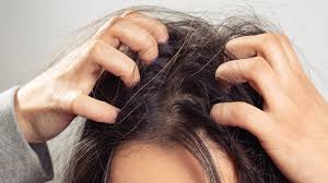 No, i do not agree with this statement. Scalp Build Up Definition Causes And How To Get Rid Of It