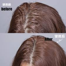 When i was ~15 years old, i could lean over and scratch my head and make it look like. Dry Shampoo Hair Powder Fix Oily Hair Greasy Hair Thick Fluffy Instantly Hair Styling Powder Tool Hair Sprays Aliexpress