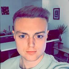 Chris Durbin's Hair Transplant Success: Defying Baldness