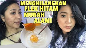 12 cara menghilangkan kutil secara alami, gak. Cara Menghilangkan Flek Hitam Di Wajah Secara Mudah Murah Cepat Dan Alami Anti Ribet Youtube