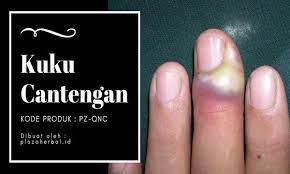 Account Suspended Kuku