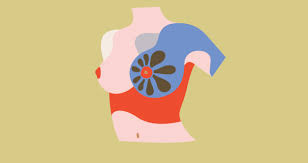 Regular physical activity, mild or intense, before or after menopause helps to reduce breast cancer risk. Breast Cancer Risk For Post Menopausal Women Taking Hormones Can Increase Your Risk Survivornet