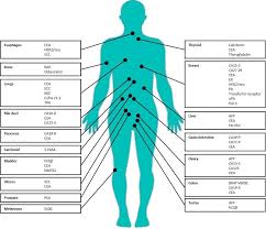 Tumor markers are used to help detect, diagnose, and manage some types of cancer. Protein Tumor Markers