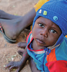 飢餓危機更是兒童危機