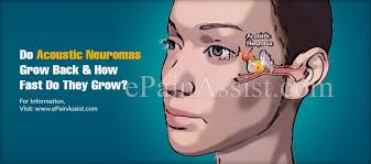 Before we can start talking about how fast succulents grow, you need to understand exactly what type of plants you find in this group. Do Acoustic Neuromas Grow Back How Fast Do They Grow