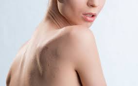 For meg var dette et gjennombrudd fra en serie ubrukelige søk. Kviser Pa Ryggen Vitusapotek