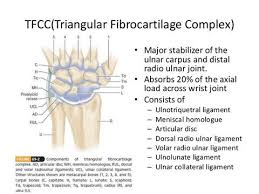 Here we explain the symptoms, causes and treatment for a. Pin On Tfcc Injury Daelyn S Wrist Injury