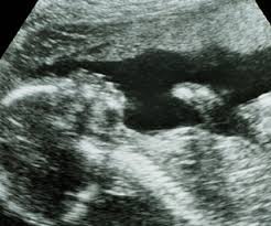 Check spelling or type a new query. You Are 22 Weeks And 4 Days Pregnant Familyeducation